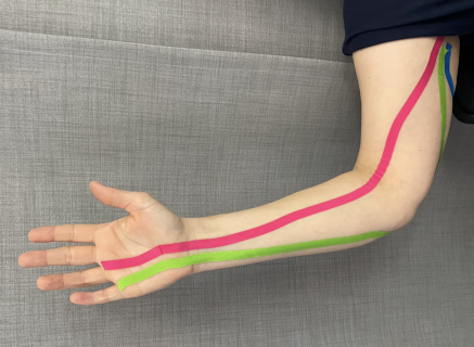 Handtherapie Nervenkurs