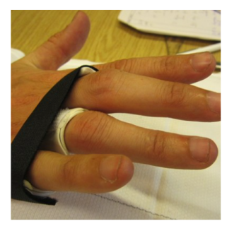 Handtherapie Basiskurs